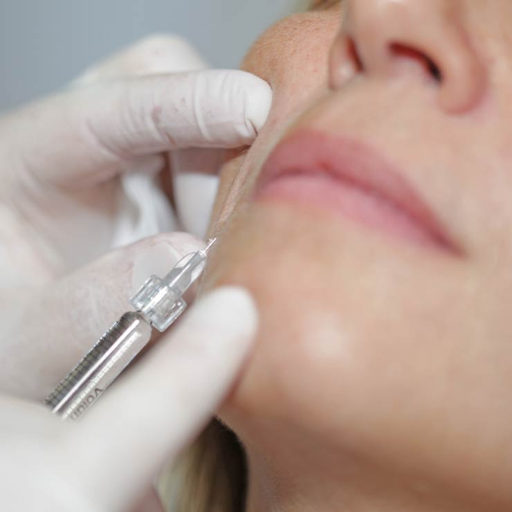 Botox Nebenwirkungen, Korrekturmöglichkeiten München – Dr. Christina Günter